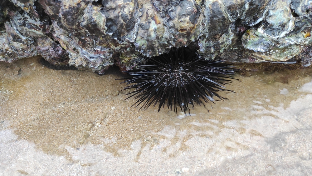 Sea urchin stings